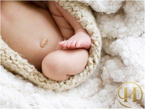 Trẻ bị rốn lồi có phải là bệnh không?