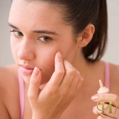 Lựa chọn cách trị mụn thịt không phù hợp sẽ không mang lại hiệu quả cao