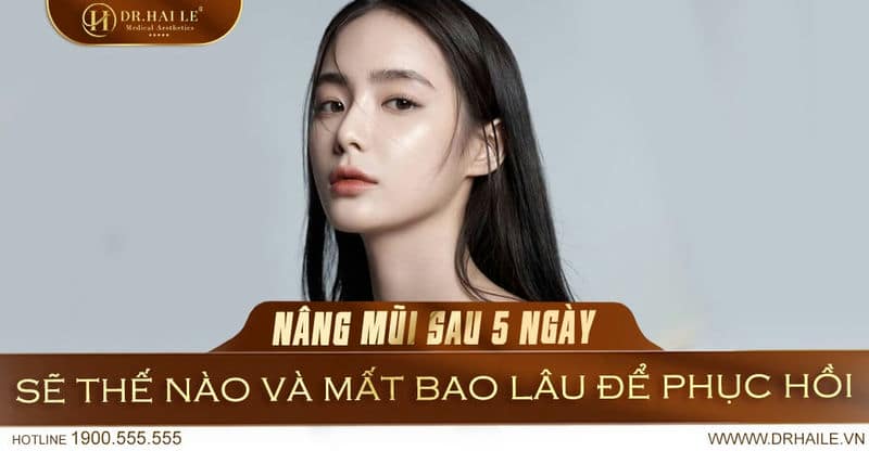 Nâng mũi sau 5 ngày sẽ thế vào và mất bao lâu để phục hồi ?