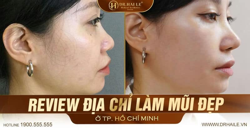 Review Địa Chỉ Nâng Mũi Đẹp TP. Hồ Chí Minh