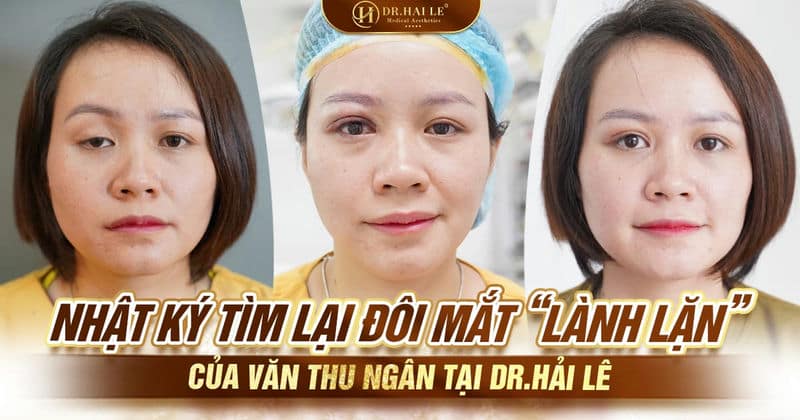 Nhật ký tìm lại đôi mắt “lành lặn” của Văn Thu Ngân tại Dr.Hải Lê Nhật ký tìm lại đôi mắt “lành lặn” của Văn Thu Ngân tại Dr.Hải Lê