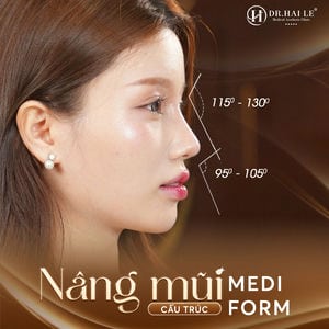 Nâng Mũi Cấu Trúc Medi-Form Nâng Mũi Cấu Trúc Medi-Form