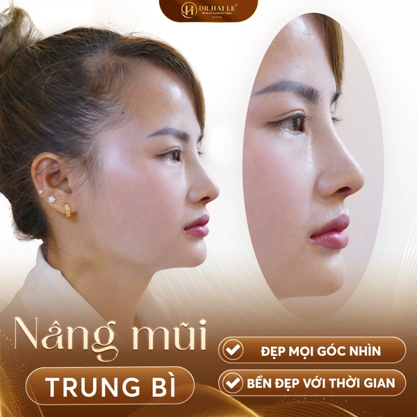 Ảnh trước sau  