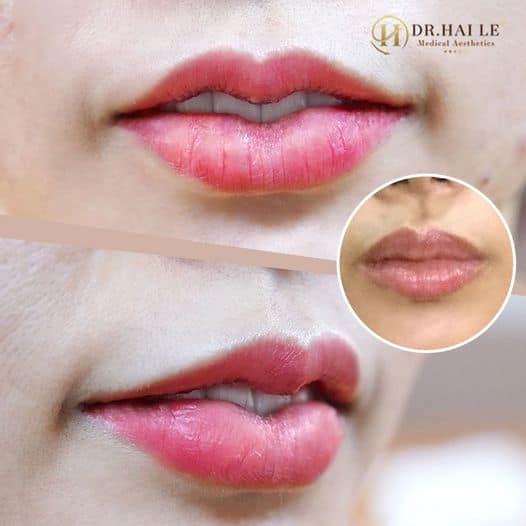 Tạo hình môi trái tim