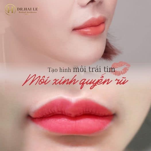 Tạo hình môi trái tim