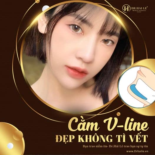 Độn cằm bằng Filler