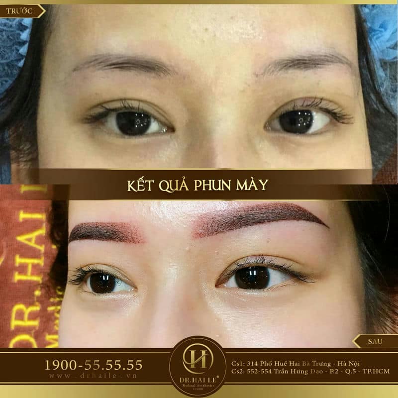 Phun xăm lông mày