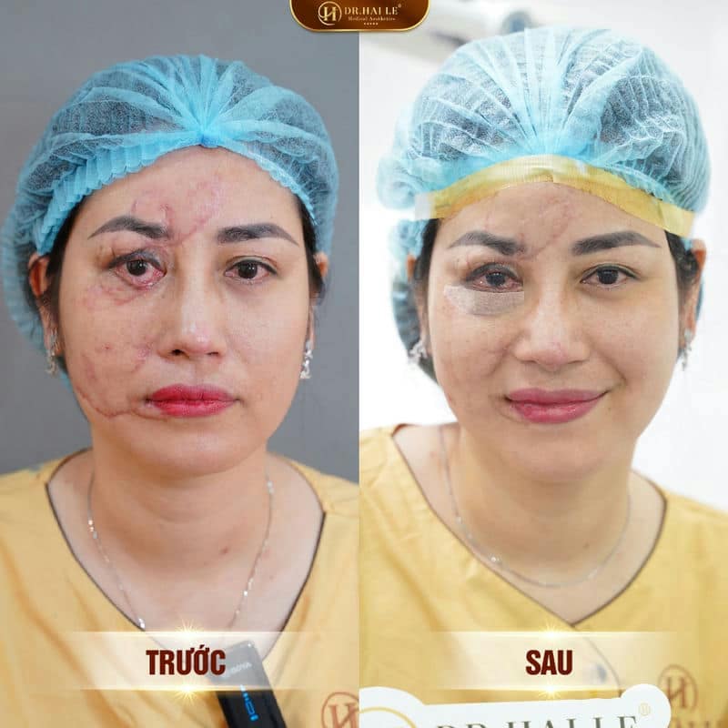 Ảnh trước sau  
