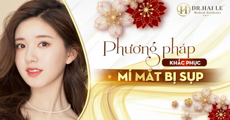 Phương pháp khắc phục mí mắt bị sụp