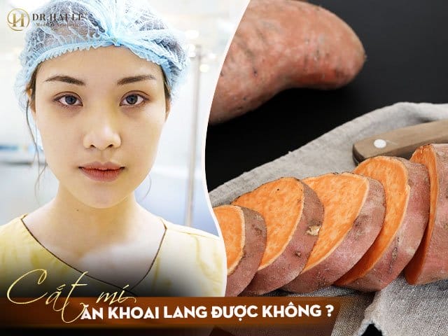 Cắt mí mắt ăn khoai lang được không?
