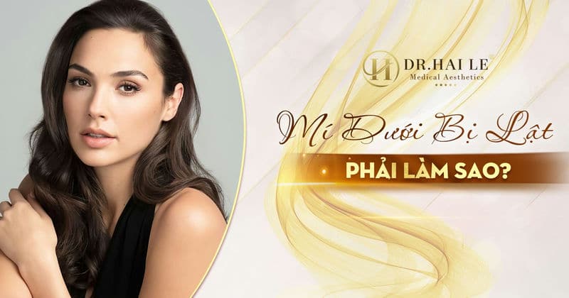 Mí dưới bị lật phải làm sao?