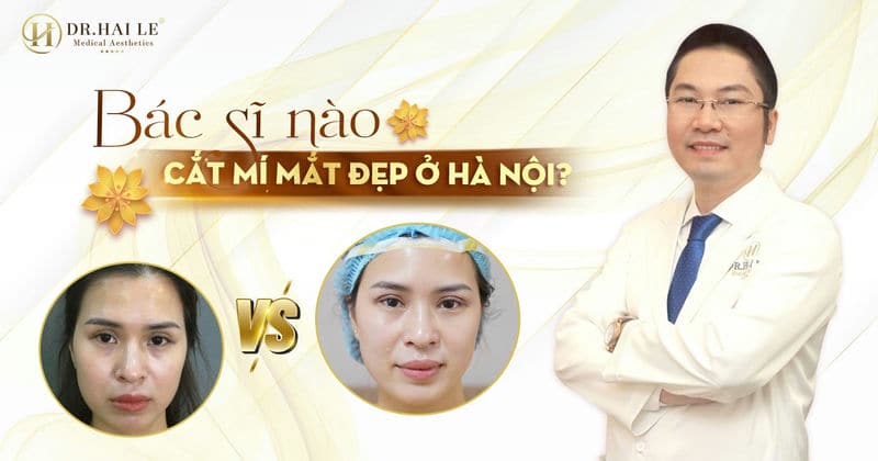 Bác sĩ nào cắt mí mắt đẹp ở Hà Nội?