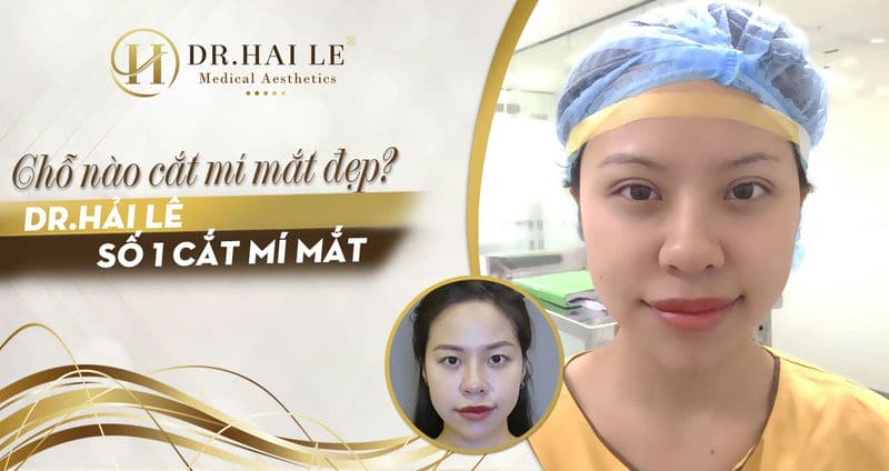 Chỗ nào cắt mí mắt đẹp TMV Dr.Hải Lê số 1 cắt mí mắt