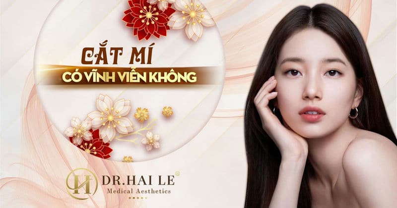 Cắt mí có vĩnh viễn không?