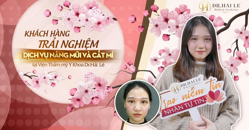 Khách hàng trải nghiệm dịch vụ nâng mũi và cắt mí tại Viện Thẩm mỹ Y Khoa Dr.Hải Lê