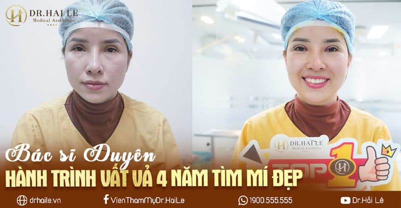 Bác sĩ Duyên - Hành trình vất vả 4 năm tìm mí đẹp Bác sĩ Duyên - Hành trình vất vả 4 năm tìm mí đẹp