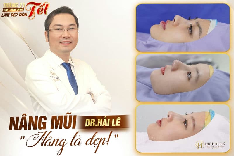 Nâng mũi Dr.Hải Lê - Nâng là đẹp!