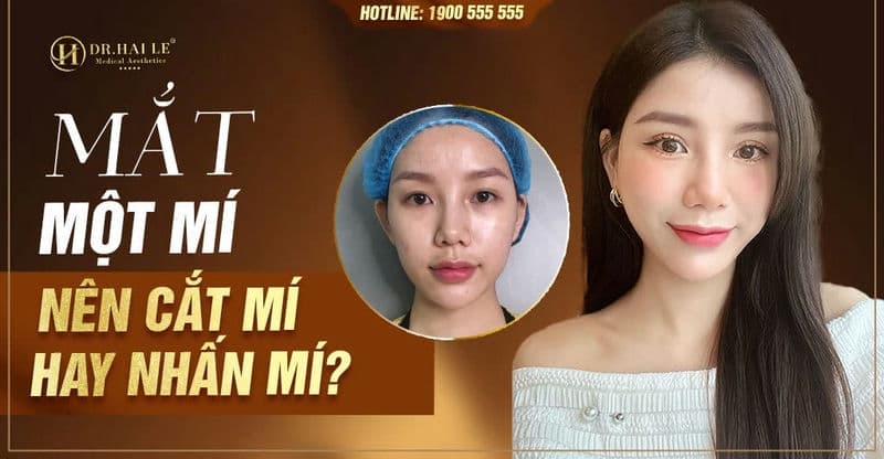 Mắt một mí nên cắt mí hay nhấn mí?