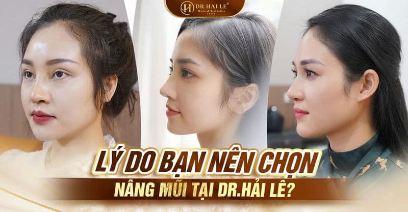Lý do bạn nên chọn nâng mũi tại Dr.Hải Lê?