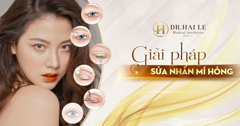 Giải pháp sửa nhấn mí hỏng