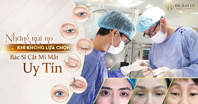 Những rủi ro khi không lựa chọn bác sĩ cắt mí mắt uy tín