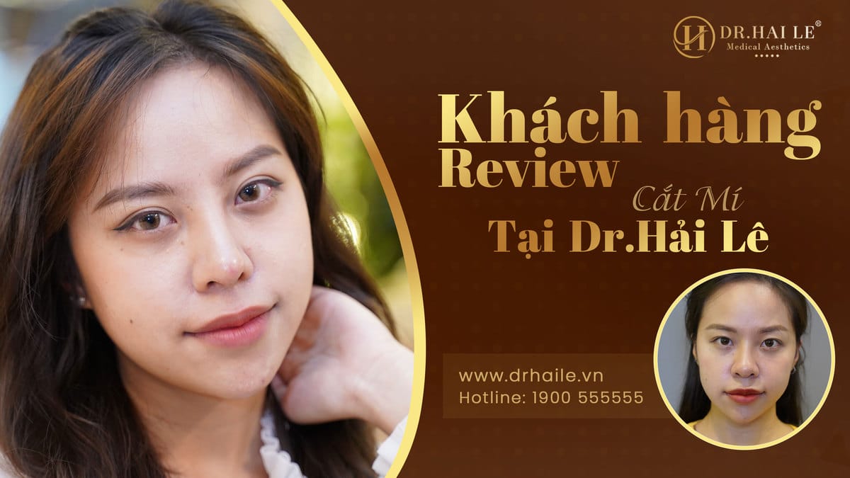 Khách hàng review cắt mí tại Dr.Hải Lê