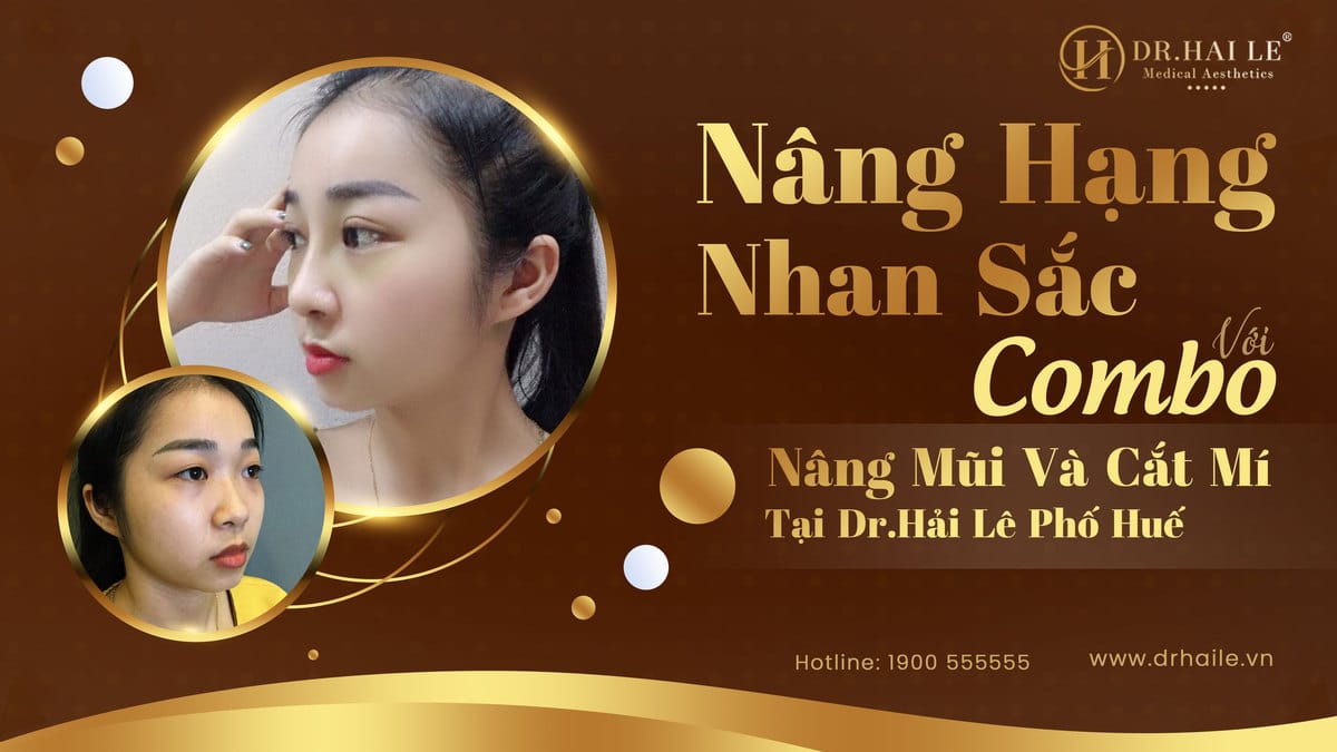 Nâng mũi và cắt mí tại Hải Lê Phố Huế