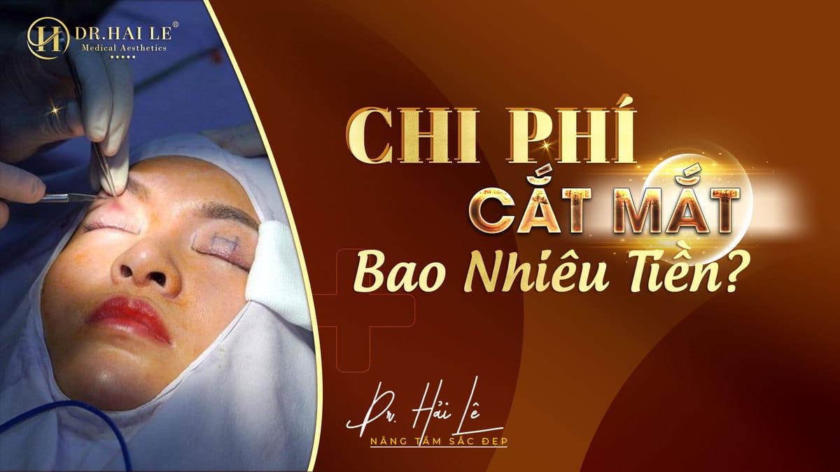 Chi phí cắt mắt bao nhiêu tiền?