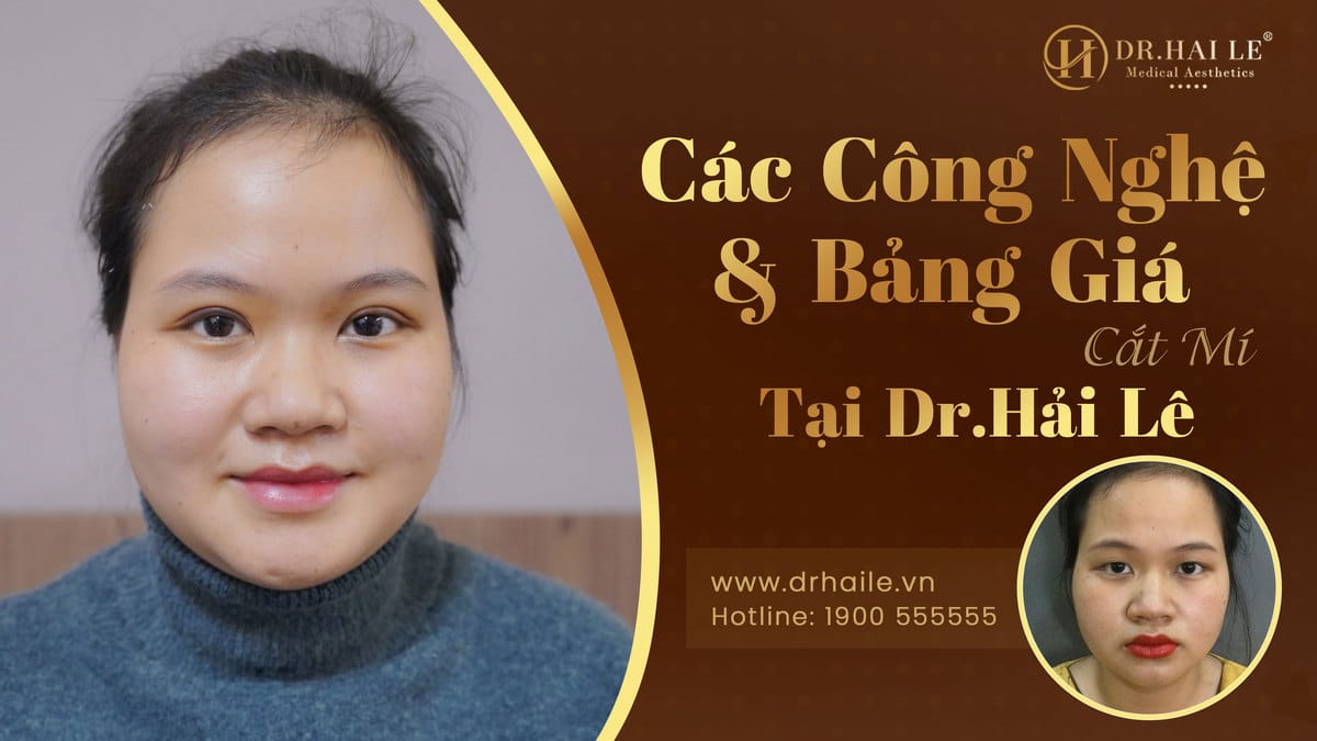 Các công nghệ và bảng giá cắt mí - Dr.Hải Lê