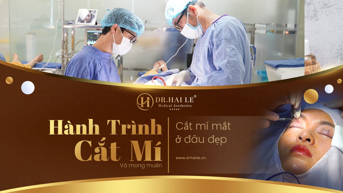 Hành trình cắt mí và mong muốn cắt mí mắt ở đâu đẹp
