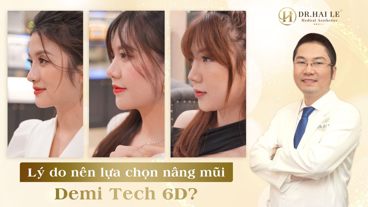 Lý do nên lựa chọn nâng mũi Demi Tech 6D?
