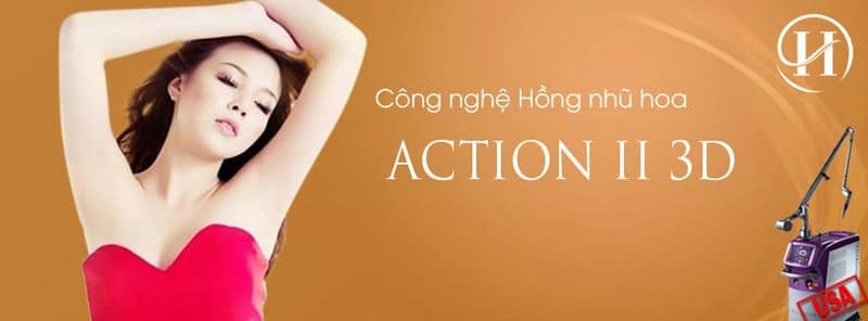 làm hồng nhũ hoa bằng laser 
