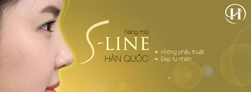 Nâng mũi S-Line không phẫu thuật
