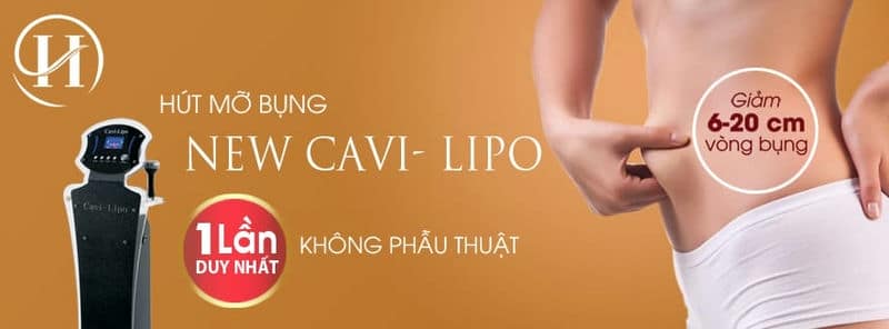 "Thổi bay" mỡ thừa hiệu quả tới 95% với công nghệ New Cavi-lipo