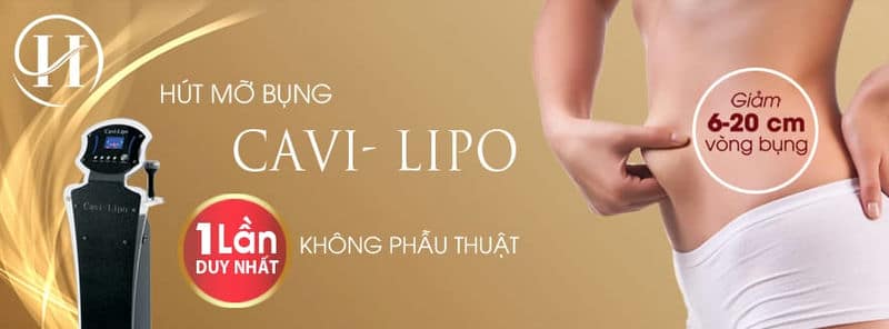 Công nghệ hút mỡ