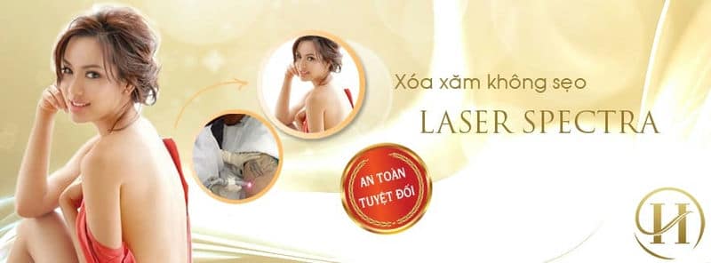 Bí quyết xóa xăm đơn giản bằng 