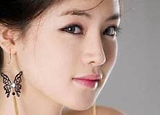 Nâng mũi 2 lớp double S có an toàn không?