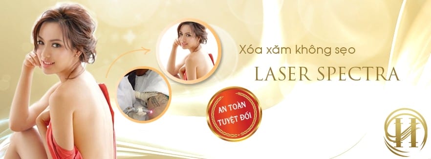 Xóa xăm bằng Laser Spectra an toàn và không sẹo