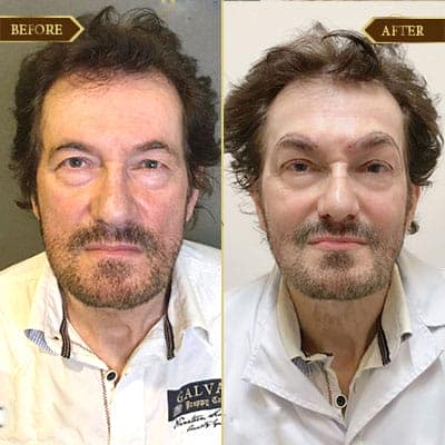 Khách hàng Sanzed, CHLB Đức