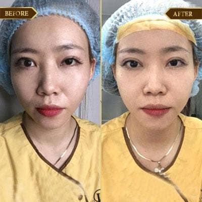 Nguyễn Diệu Linh, 28 tuổi, TP HCM