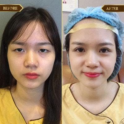 Hồng Linh, 28 tuổi, Quảng Ninh