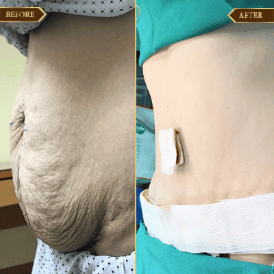 Hoàng Thị Thu, 43 tuổi