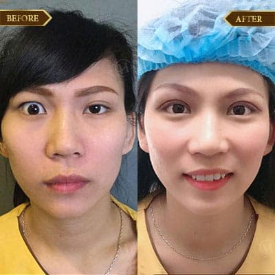 Lê Thị Phương, 30 tuổi, Hà Nam