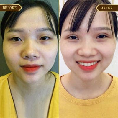 Lê Huệ, 27 tuổi, Hải Dương