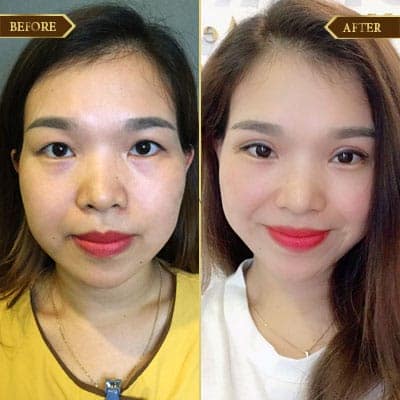 Nguyễn Thị Nhung, 30 tuổi, Hà Nội