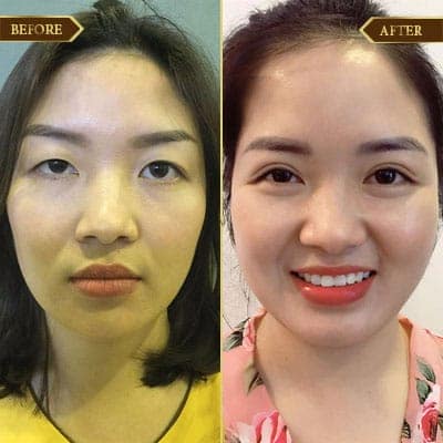 Thu Phương, 30 tuổi, Hải Phòng