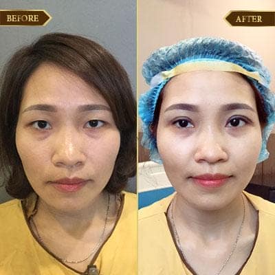 Thu Tâm, 35 tuổi, Quảng Ninh