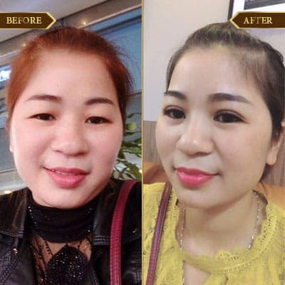 Chu Thị Hằng 34 tuổi, Vũ Thư - Thái Bình