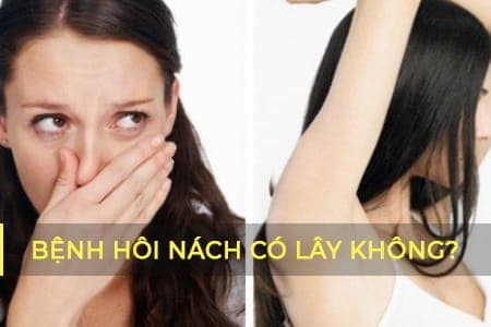 Bệnh hôi nách có lây không?