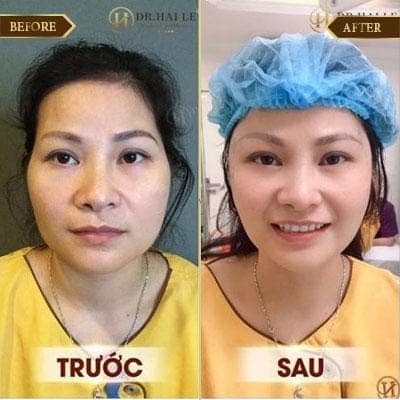 Hạ Linh, 33 tuổi, Đông Anh